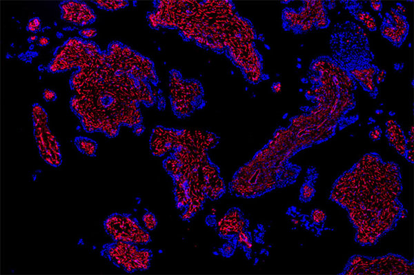 Single-cell RNA-Seq of cells in the early human placenta may shed light on problem pregnancies